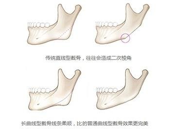 案例图片