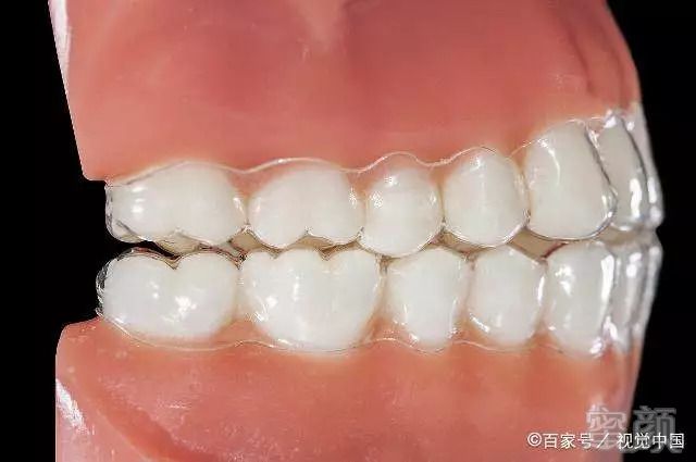 https://img.miyanlife.com/mnt/timg/180905/12433H630-0.jpg