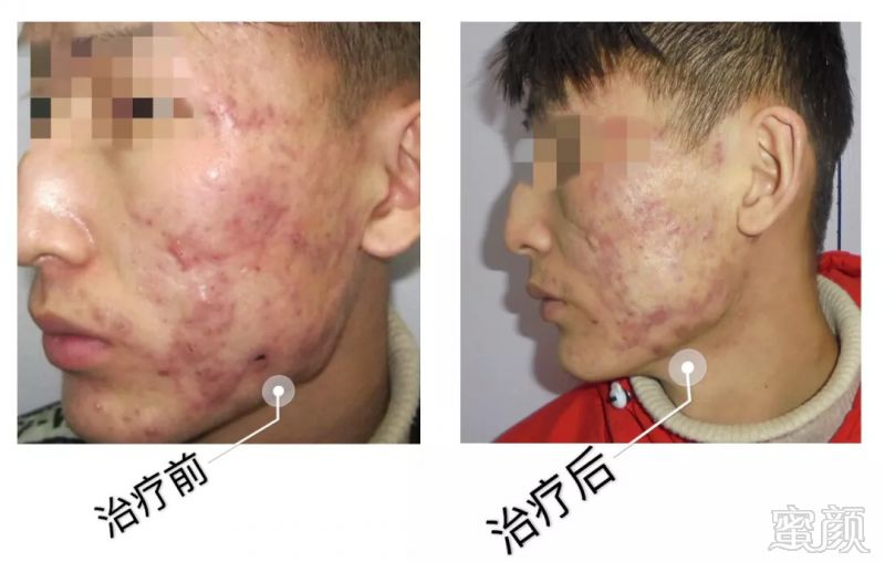 https://img.miyanlife.com/mnt/timg/180905/124S94226-8.jpg