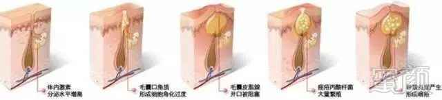 https://img.miyanlife.com/mnt/timg/180905/124ST222-6.jpg