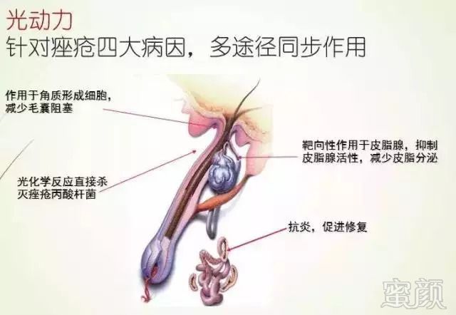 https://img.miyanlife.com/mnt/timg/180905/124ST631-5.jpg