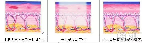 https://img.miyanlife.com/mnt/timg/180905/12523a3C-5.jpg