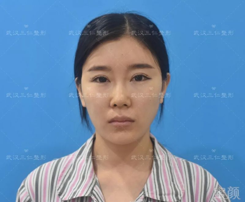 https://img.miyanlife.com/mnt/timg/180905/13503013I-1.jpg