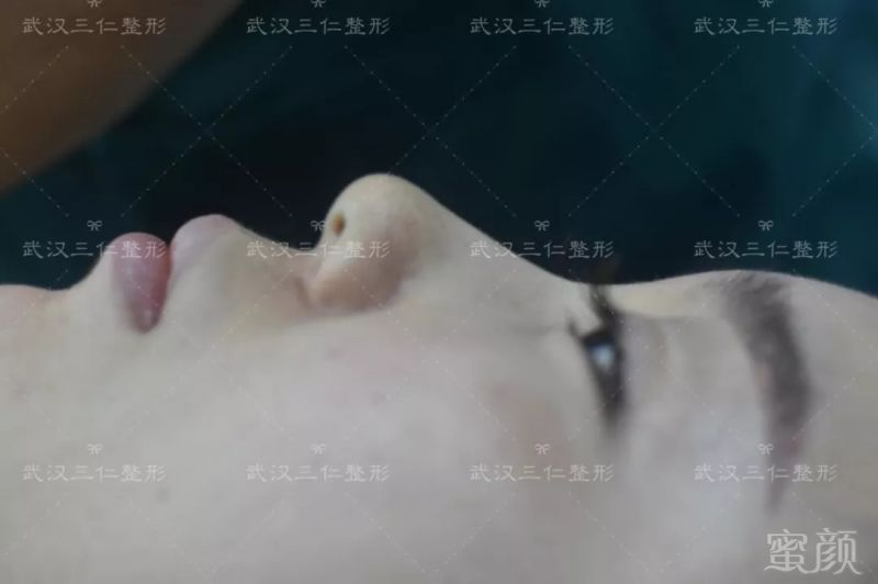https://img.miyanlife.com/mnt/timg/180905/1350312539-2.jpg
