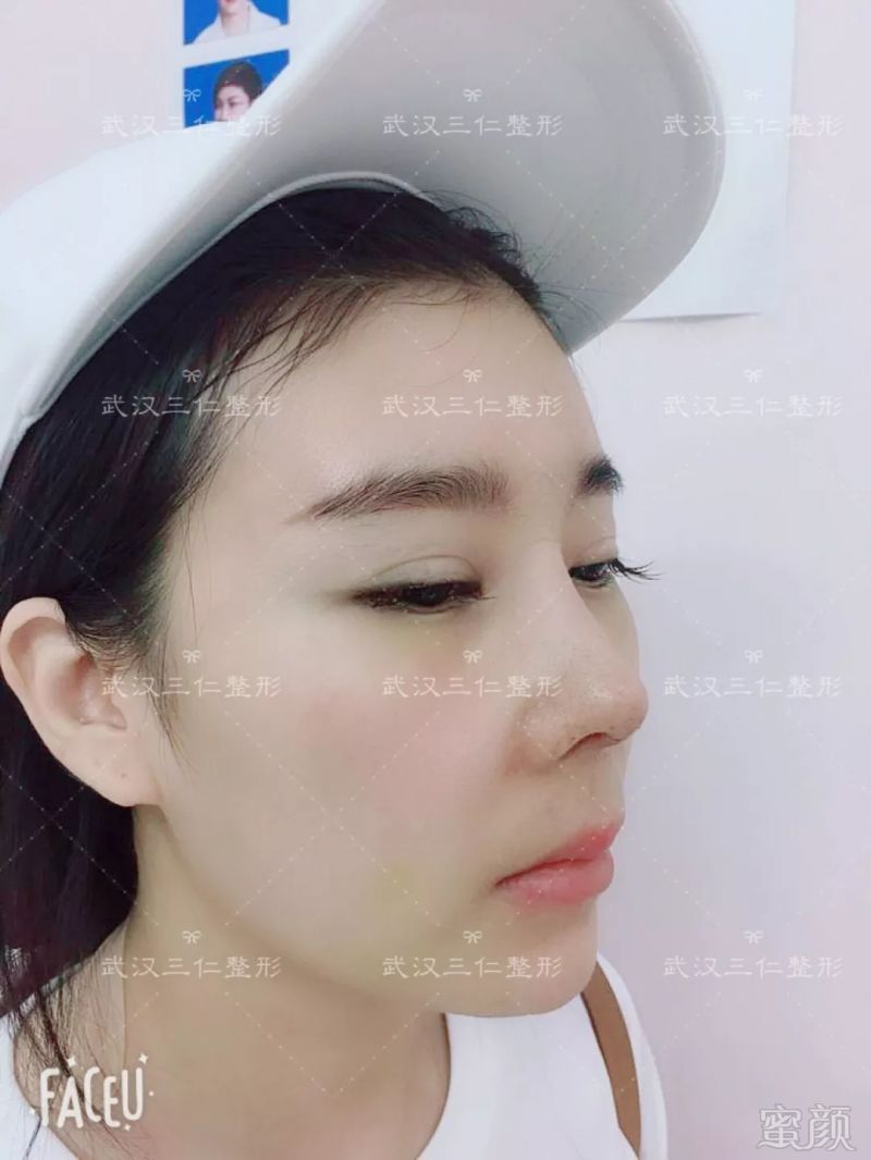 https://img.miyanlife.com/mnt/timg/180905/1350331614-6.jpg
