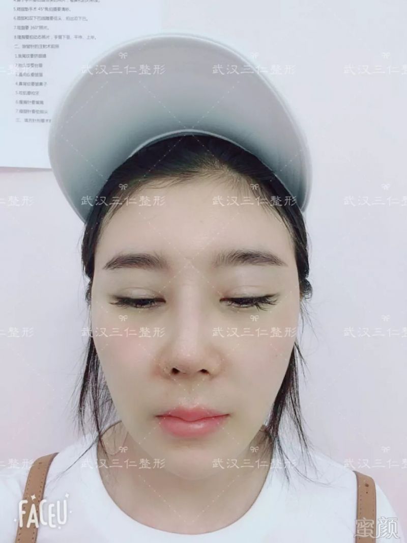 https://img.miyanlife.com/mnt/timg/180905/1350334328-5.jpg
