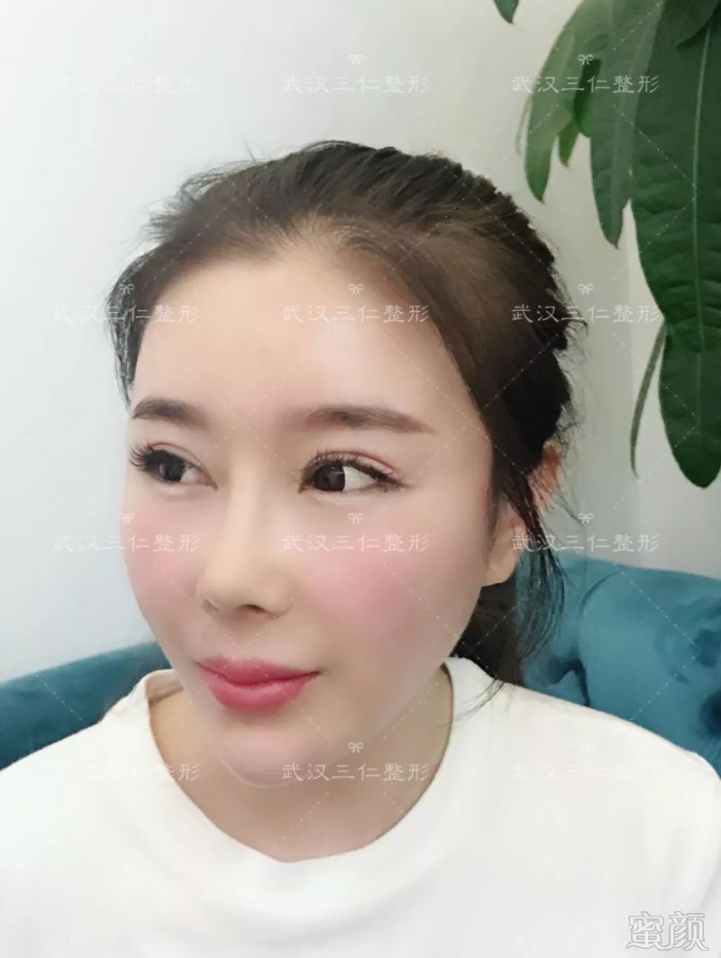 https://img.miyanlife.com/mnt/timg/180905/1350351392-9.jpg