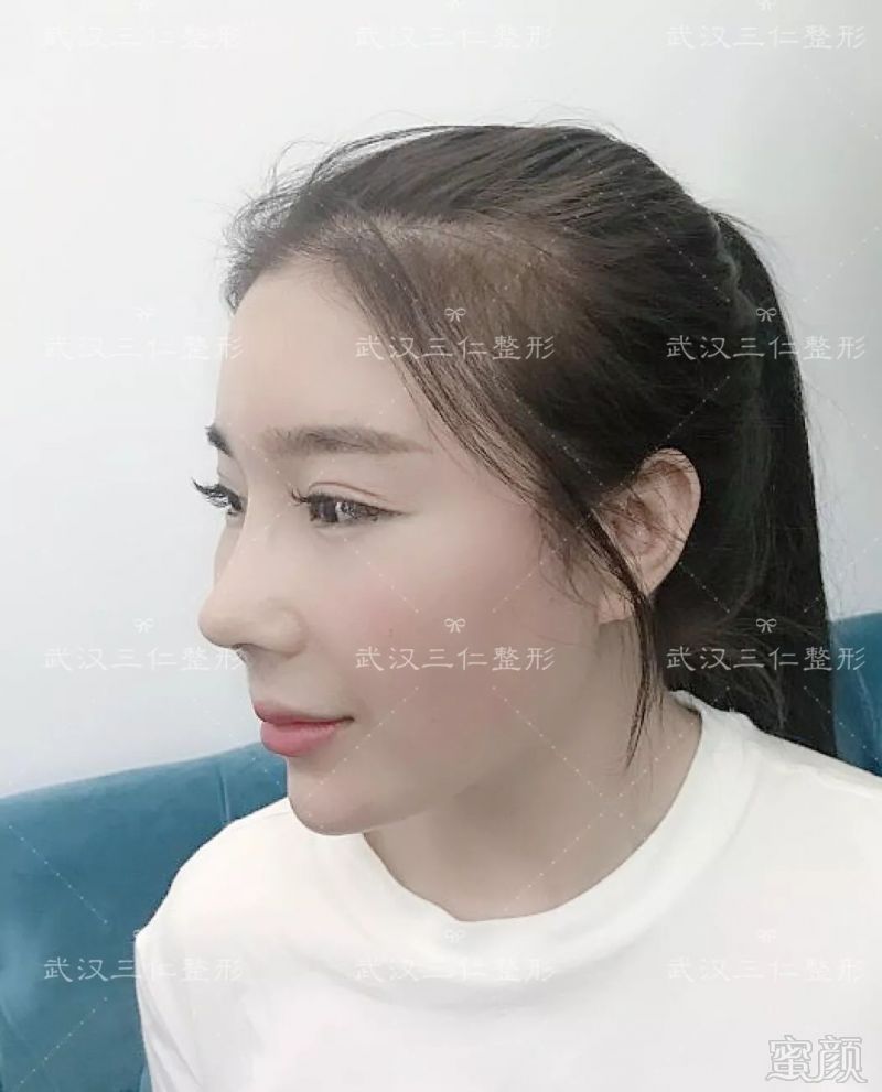 https://img.miyanlife.com/mnt/timg/180905/1350351W6-8.jpg