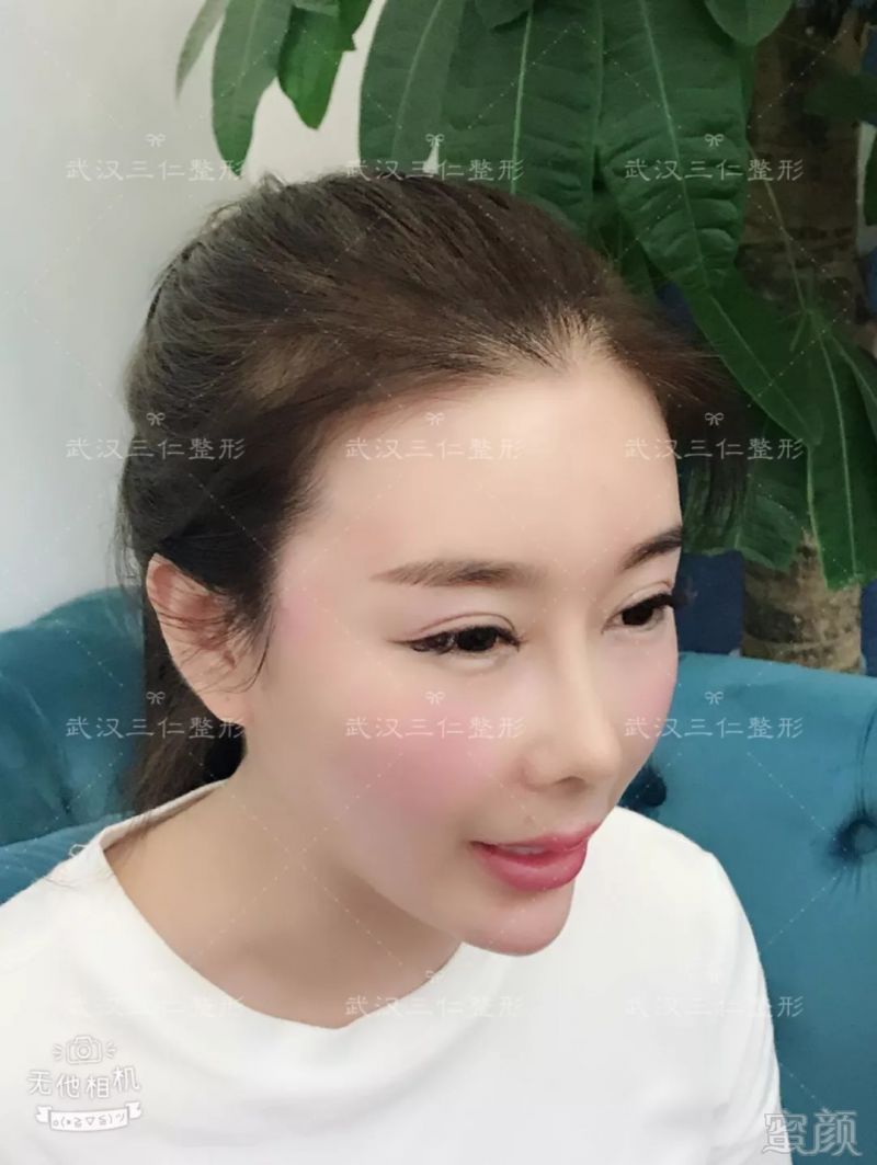 https://img.miyanlife.com/mnt/timg/180905/1350364461-10.jpg
