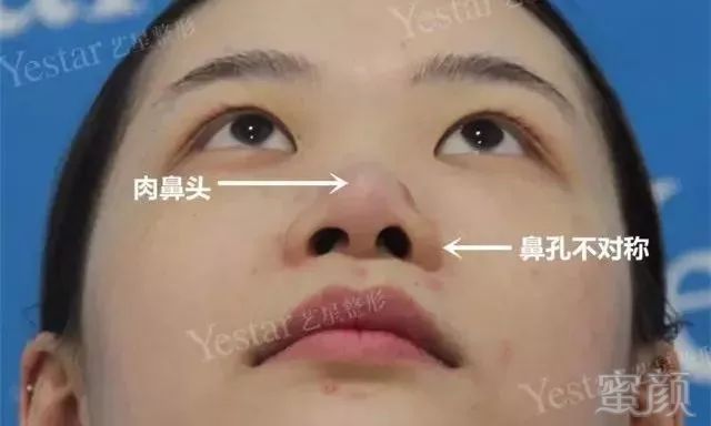 https://img.miyanlife.com/mnt/timg/180905/1401101P7-4.jpg