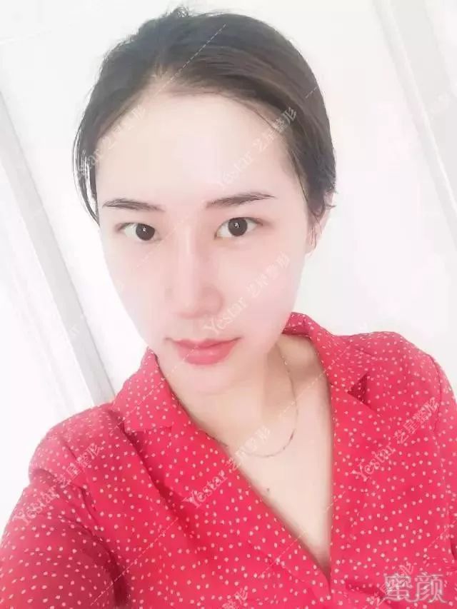https://img.miyanlife.com/mnt/timg/180905/1401131Z2-9.jpg
