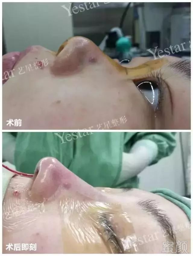 https://img.miyanlife.com/mnt/timg/180905/1401134516-6.jpg