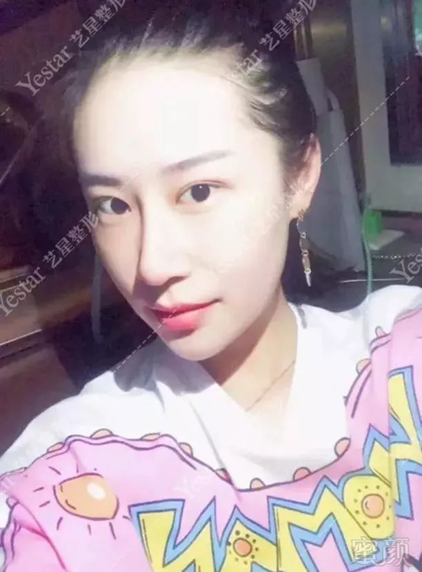 https://img.miyanlife.com/mnt/timg/180905/140114LO-11.jpg