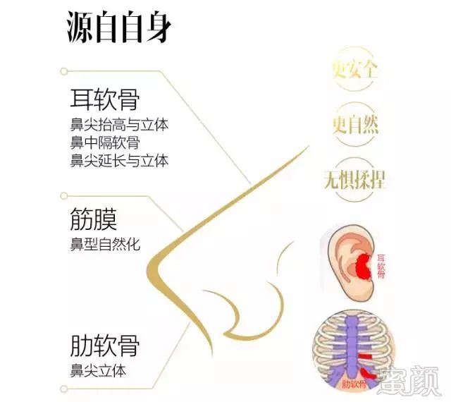 https://img.miyanlife.com/mnt/timg/180905/1401154041-14.jpg