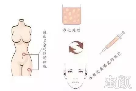 https://img.miyanlife.com/mnt/timg/180905/14012L231-10.jpg