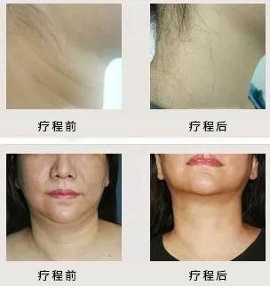 https://img.miyanlife.com/mnt/timg/180905/1404335426-9.jpg