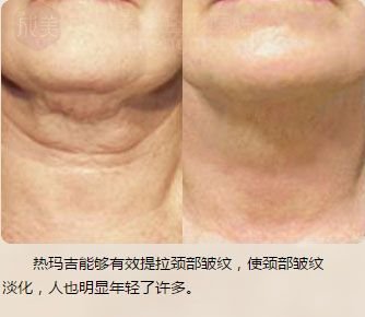 https://img.miyanlife.com/mnt/timg/180905/140433H14-11.jpg