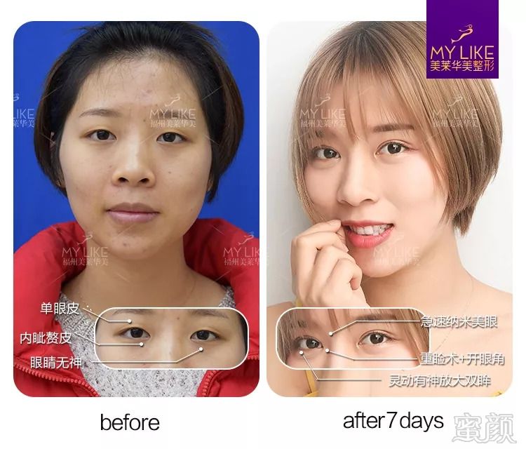 https://img.miyanlife.com/mnt/timg/180905/1404595V2-1.jpg