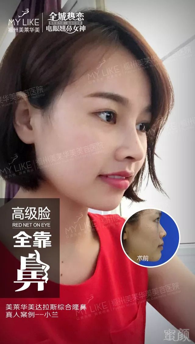 https://img.miyanlife.com/mnt/timg/180905/14045aa5-2.jpg