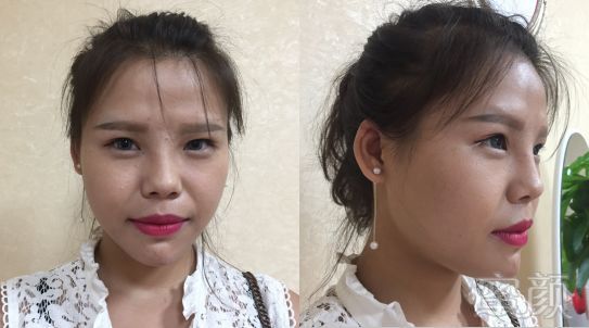 https://img.miyanlife.com/mnt/timg/180905/1409124A0-2.jpg