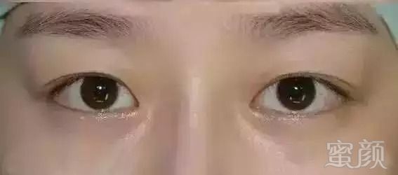https://img.miyanlife.com/mnt/timg/180905/140R32G1-0.jpg