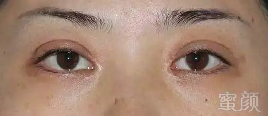 https://img.miyanlife.com/mnt/timg/180905/140R34402-1.jpg