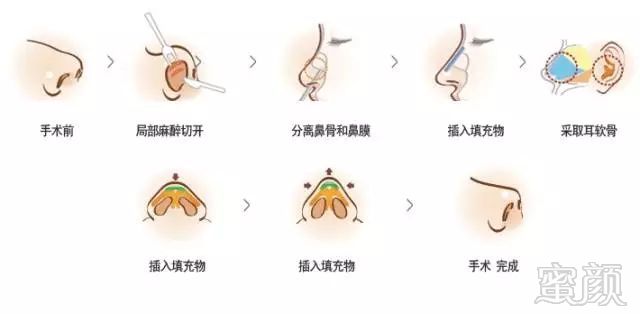 https://img.miyanlife.com/mnt/timg/180905/151H12008-5.jpg