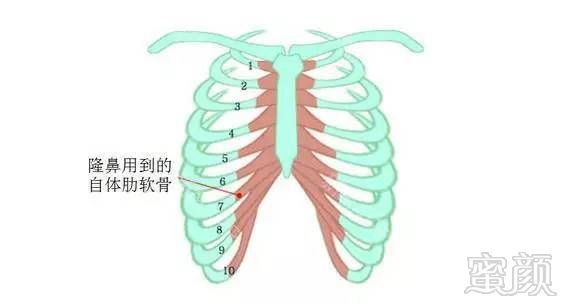 https://img.miyanlife.com/mnt/timg/180905/151H15314-3.jpg