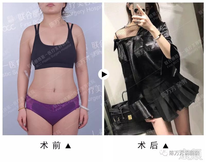 https://img.miyanlife.com/mnt/timg/180905/151J92230-2.jpg