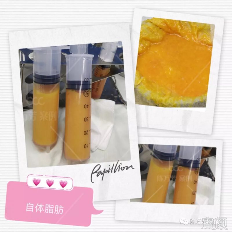 https://img.miyanlife.com/mnt/timg/180905/151J92H0-1.jpg