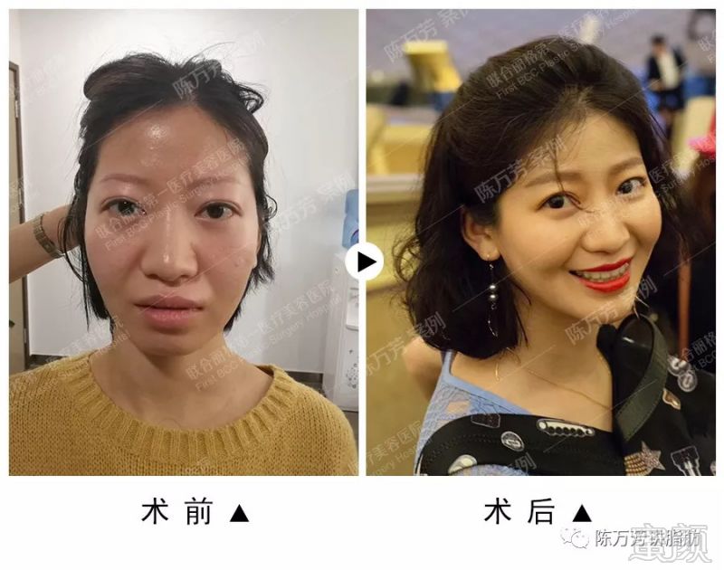 https://img.miyanlife.com/mnt/timg/180905/151JU964-0.jpg
