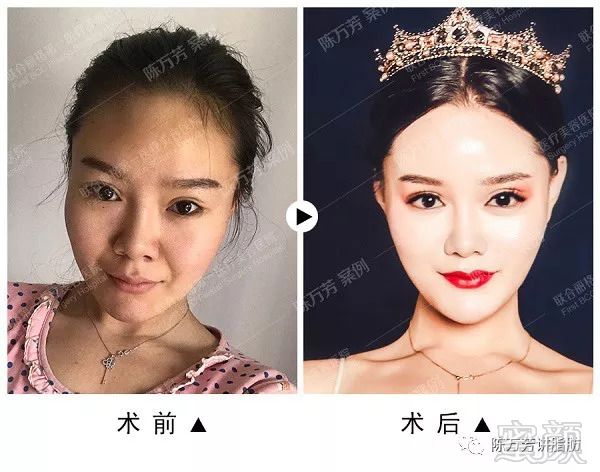 https://img.miyanlife.com/mnt/timg/180905/151K1C30-6.jpg