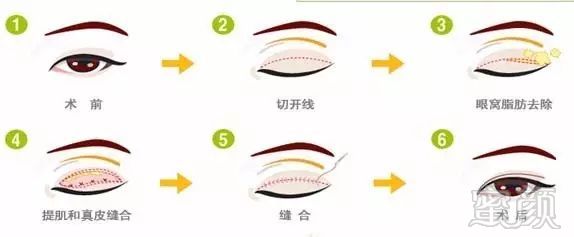 https://img.miyanlife.com/mnt/timg/180905/151K33I8-0.jpg