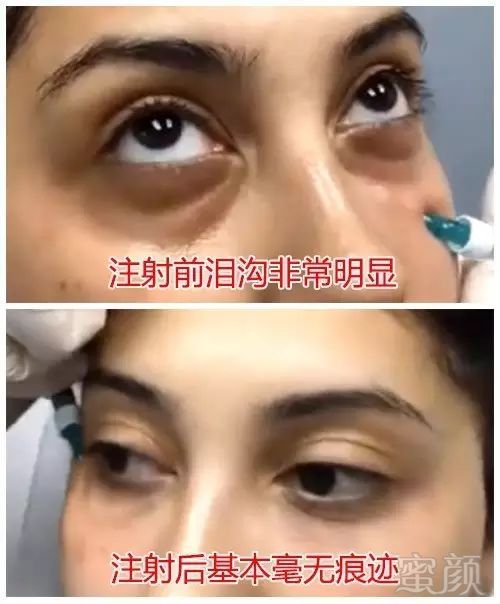https://img.miyanlife.com/mnt/timg/180905/15211K336-0.jpg
