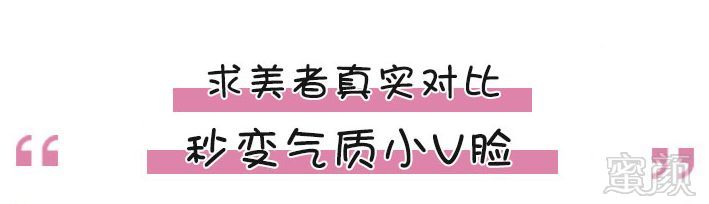 https://img.miyanlife.com/mnt/timg/180905/15213525V-4.jpg