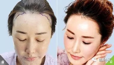 https://img.miyanlife.com/mnt/timg/180905/1521394W7-2.jpg