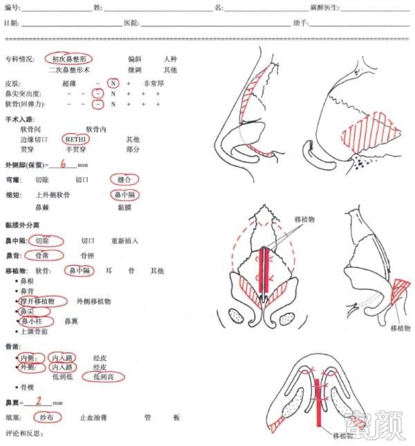 案例图片