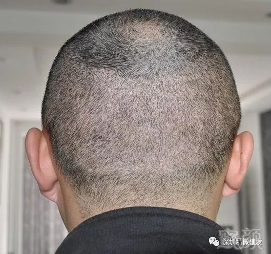 https://img.miyanlife.com/mnt/timg/180906/1102046410-1.jpg