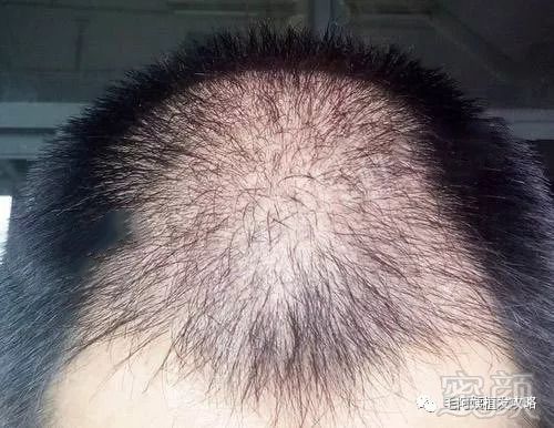 https://img.miyanlife.com/mnt/timg/180906/110T42R3-4.jpg