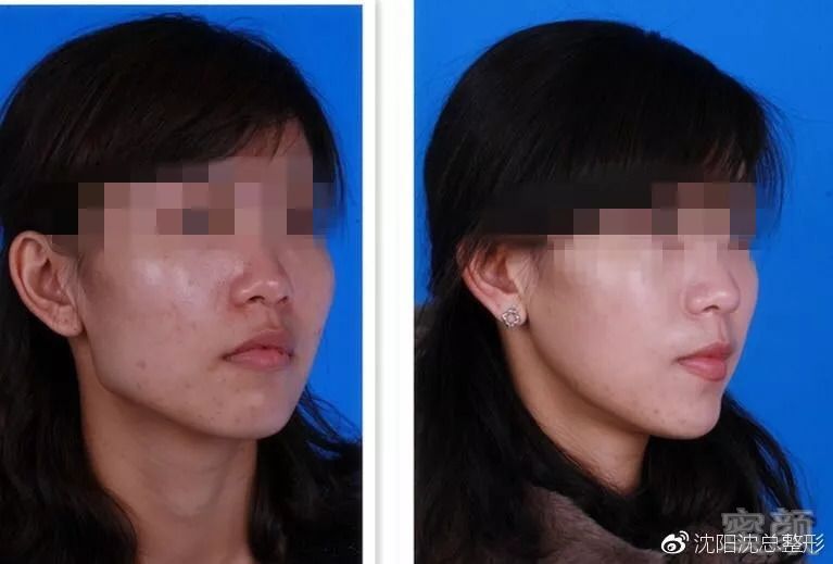 https://img.miyanlife.com/mnt/timg/180906/111KC5L-3.jpg