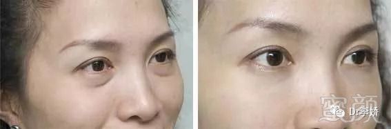 https://img.miyanlife.com/mnt/timg/180906/1121211052-3.jpg