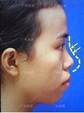 https://img.miyanlife.com/mnt/timg/180906/11392BF8-1.jpg