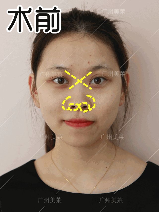 https://img.miyanlife.com/mnt/timg/180906/113930A28-4.jpg