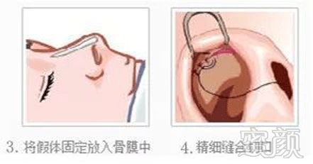 https://img.miyanlife.com/mnt/timg/180906/113931D55-11.jpg