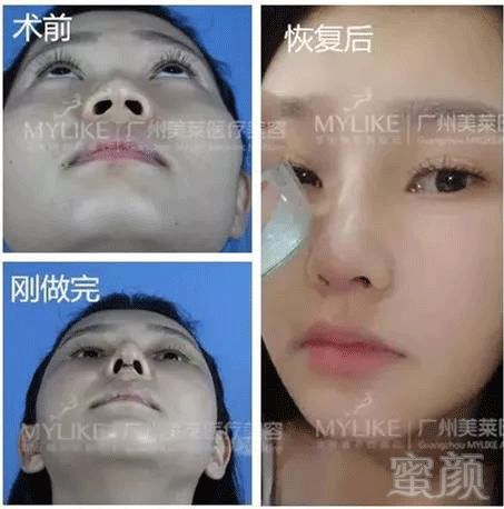 https://img.miyanlife.com/mnt/timg/180906/113932F09-13.jpg