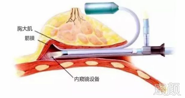 案例图片