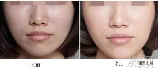 https://img.miyanlife.com/mnt/timg/180906/1140032Z0-1.jpg