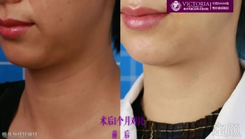 https://img.miyanlife.com/mnt/timg/180906/1204214G9-10.jpg