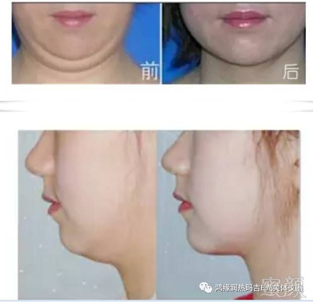 https://img.miyanlife.com/mnt/timg/180906/120I33S1-5.jpg