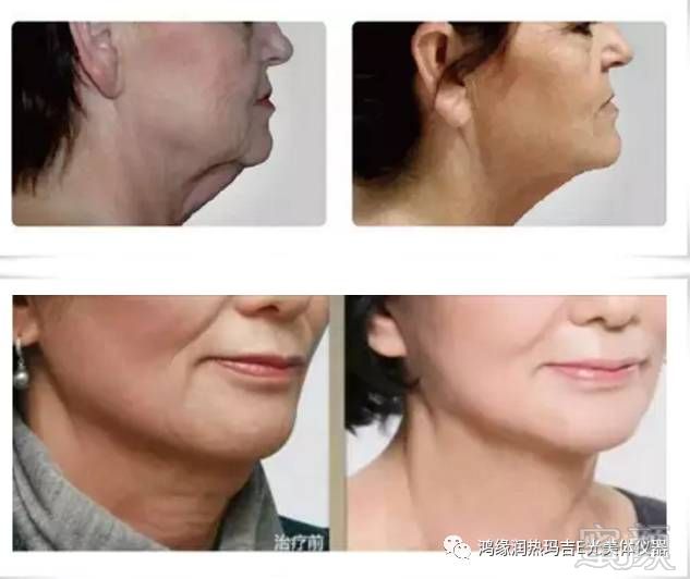https://img.miyanlife.com/mnt/timg/180906/120I3M41-6.jpg